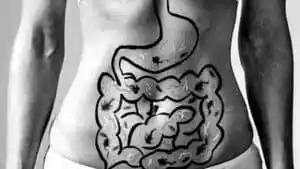 Leaky Gut: What you Need to Know to Heal Naturally.